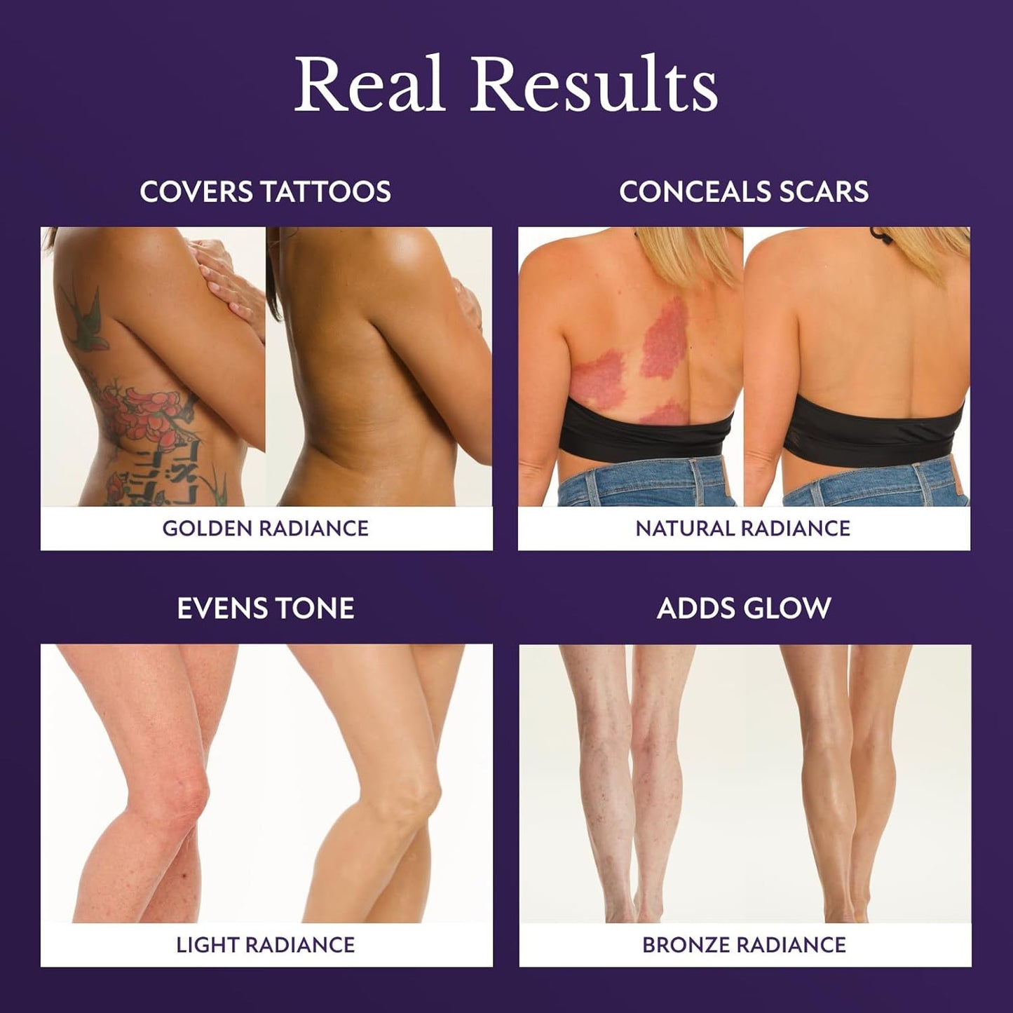 Luntra™ Beauty Body Coverage Perfector